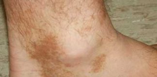 Beauty Archives - TRENDY DAMSELS